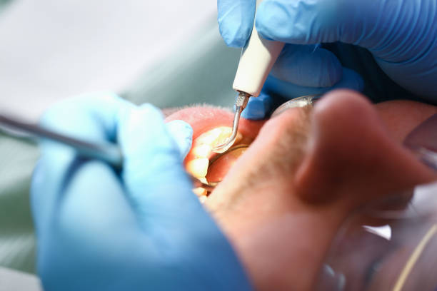 Best Pediatric Emergency Dentist in Leesville, LA