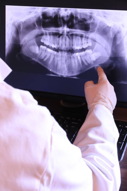 Best Emergency Root Canal Treatment in Leesville, LA