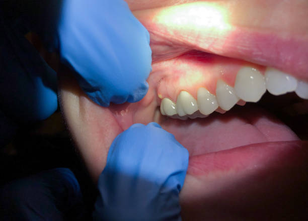 Best After-Hours Emergency Dentist in Leesville, LA