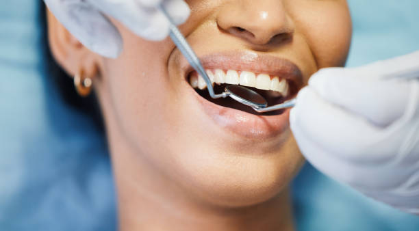 Best Emergency Tooth Extraction in Leesville, LA