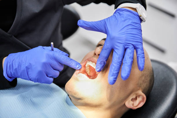 Best Emergency Root Canal Treatment in Leesville, LA