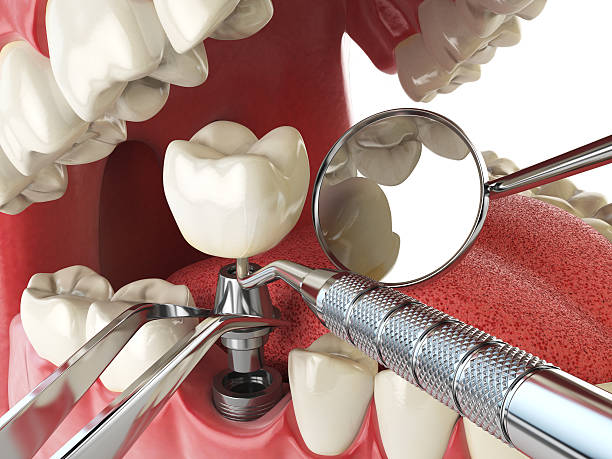 , LA Emergency Dentist Company